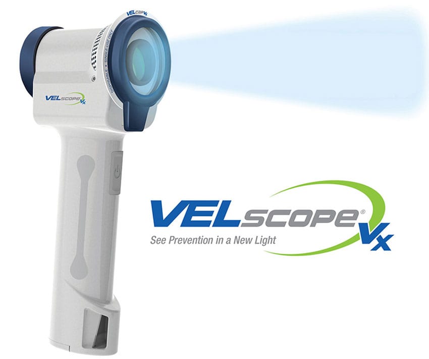 velscope,dental technology for oral cancer screening